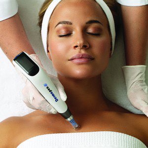IPL og Dermapenn